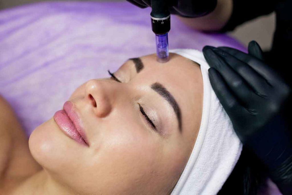 Microneedling Treatment in Pasadena, CA | SkinFX Medical Spa