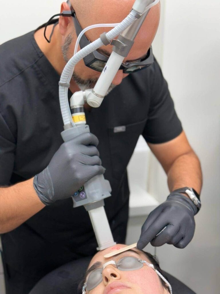 Portfolio 1 Laser Skin Resurfacing
