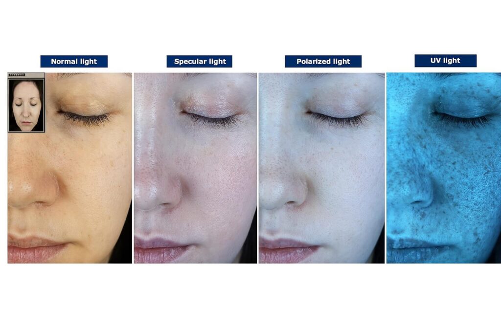 Glimpse Facial Analyzer 1 Multi-Light Skin Scan Set