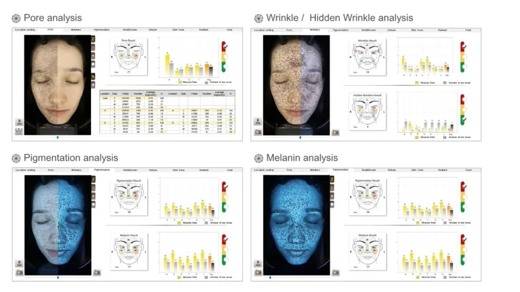 Glimpse Facial Analyzer 3 Type Skin Health Grid (Modern UI)
